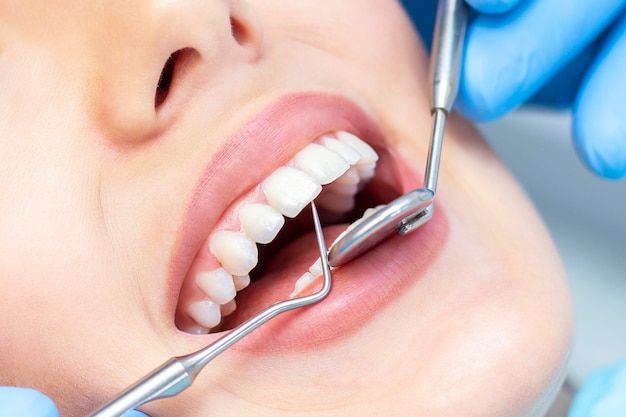 پنج اشتباه رایج در مراجعه به دندانپزشکی که بیماران باید از آن‌ها اجتناب کنند