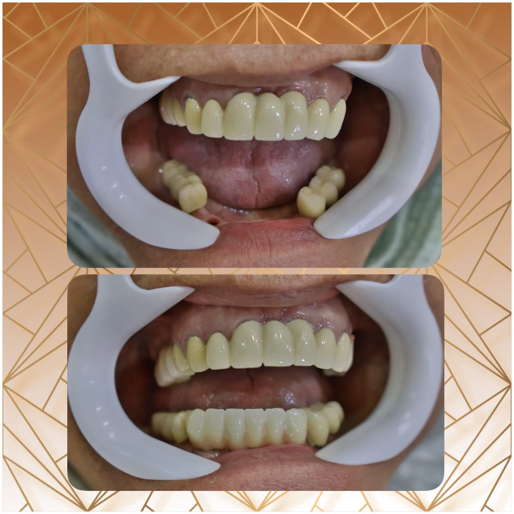 زیبایی در دندانپزشکی در سعادت اباد